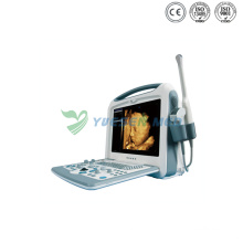 Ysb2000 4D Color Doppler Portable Ultrasound Scanner
